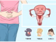 痛经——女性难言的“痛”，需警惕子宫腺肌症